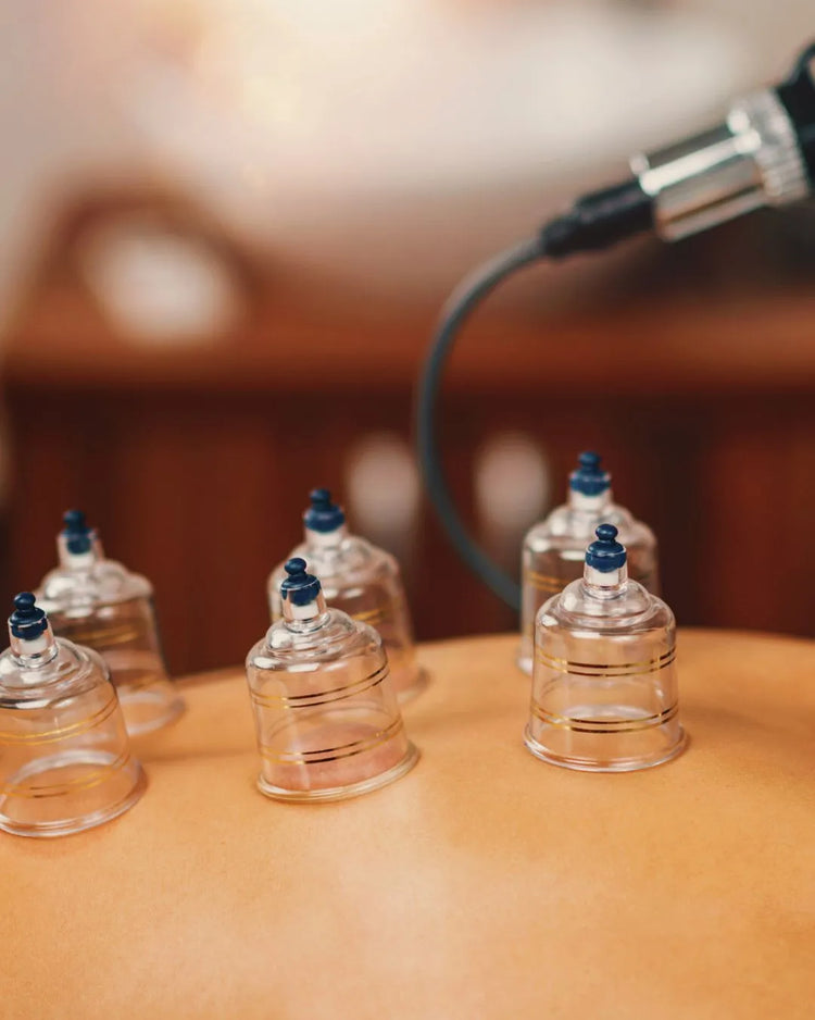 Les ventouses posées sur le dos pendant le massage