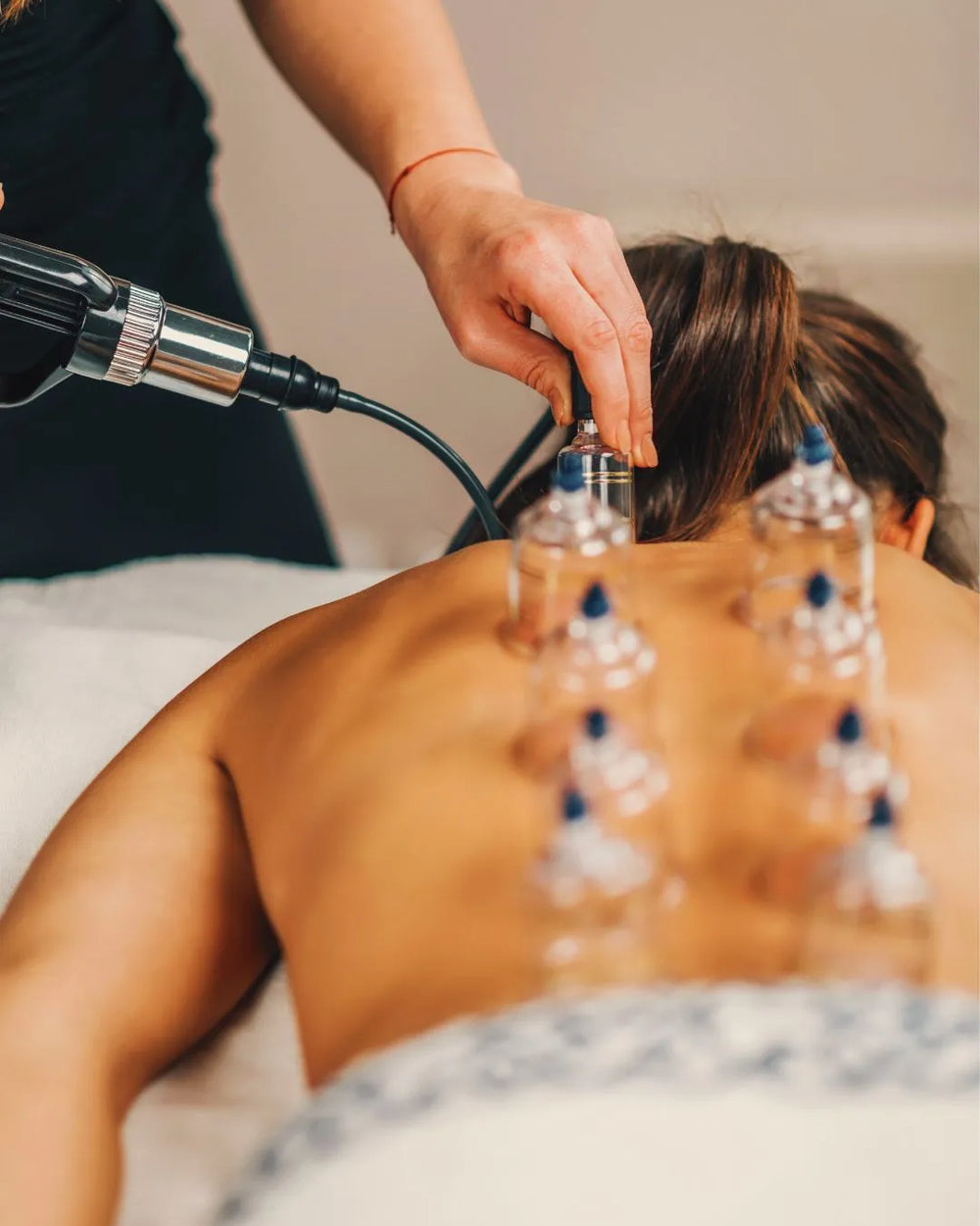 Mise en place des ventouses lors d'un massage ventouse