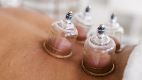 4 ventouses sur le bas du dos lors d'une séance de cupping